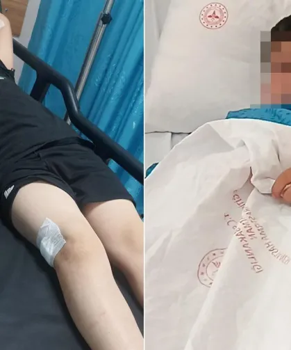 9 Yaşındaki Çocuk Parkta Oyun Oynarken Bacağından Vuruldu