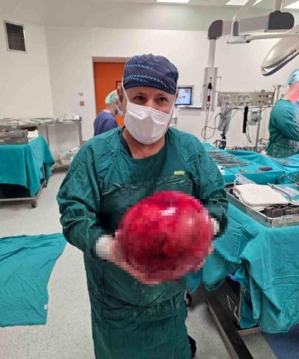 74 Yaşındaki Hastanın Karnından 6,5 Kiloluk Tümör Çıktı