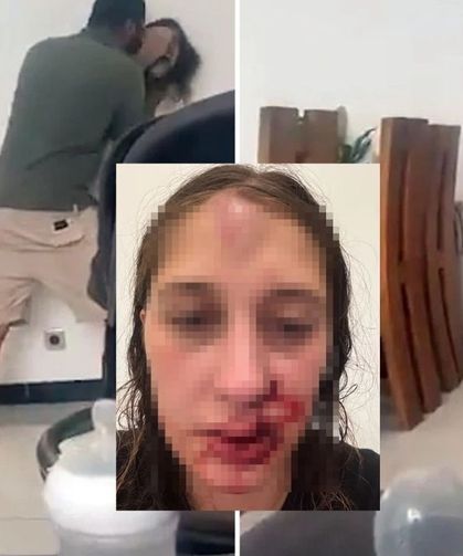 Uyuştur*cu ve Kumar Bağımlısı Eşinden Şiddet Gören Dilara Yardım Bekliyor