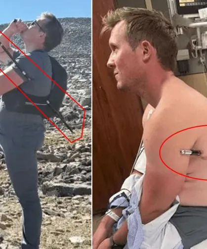 Vücudunu Delen Trekking Sopasıyla 16 Kilometre Yürüdü