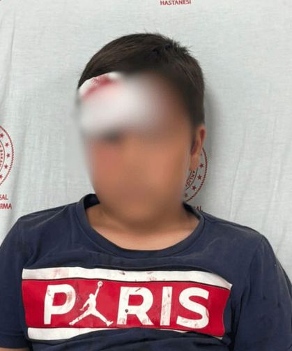 Parkta oynarken üzerine demir direk devrilen çocuk yaralandı