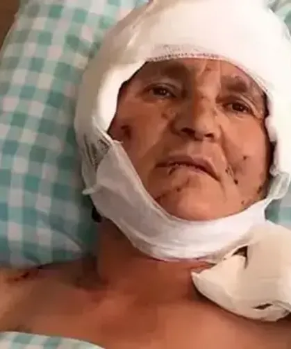 Köpek saldırısı mahkemeye taşındı! Yargıtay 637 bin TL tazminatı onadı