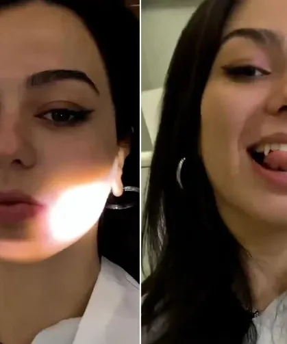 Yeni estetik akımı şaşkına çevirdi! Genç kadın “vampir dişi” yaptırdı