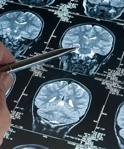 Bilim insanlarından Alzheimer için umut veren keşif: Derin uyku detayı
