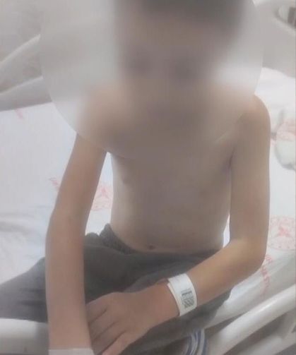 Arnavutköy'de Çocuk Ateşe Verildi, Ağır Yaralandı
