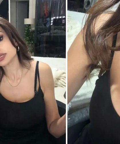 Meme estetiği yaptıran kadın kabusu yaşadı: Ciddi giden ilişkim bitti
