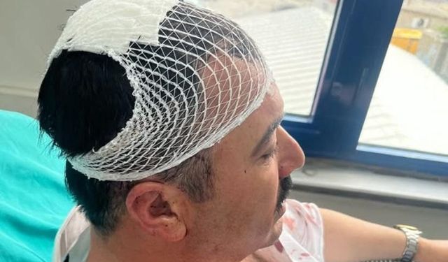 Dulkadiroğlu Belediyesi’nde Şok Saldırı, Başkan Yardımcısına Sert Cisimle Darbe!