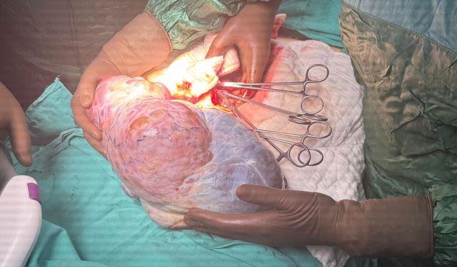 70 yaşındaki kadının karnından 5 kiloluk kitle çıkarıldı