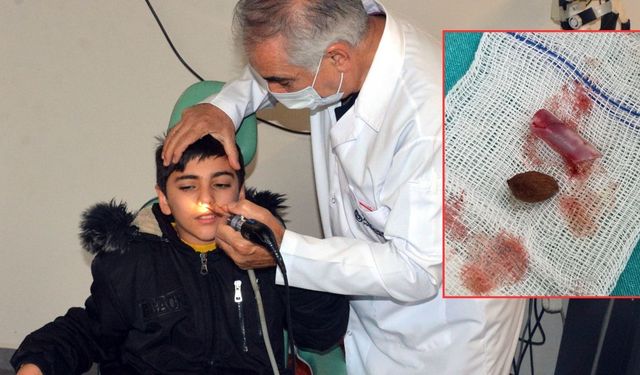 Kahramanmaraş’ta 11 Yaşındaki Çocuğun Burnundan Pipet ve Çekirdek Çıktı