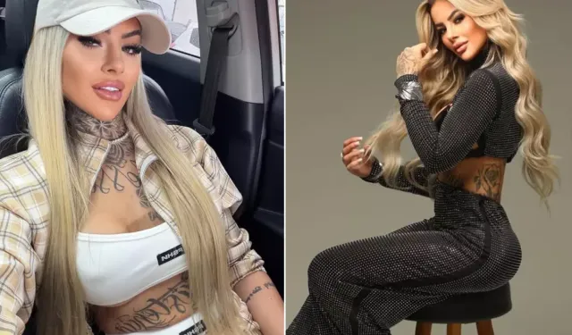 Estetik Operasyon Sonrası Akciğer Embolisi Nedeniyle Öldü