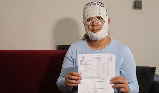 'Prenses' paketini seçti, yüzü yandı: Çocuğum beni gördü, 'öcü' diyerek kaçtı