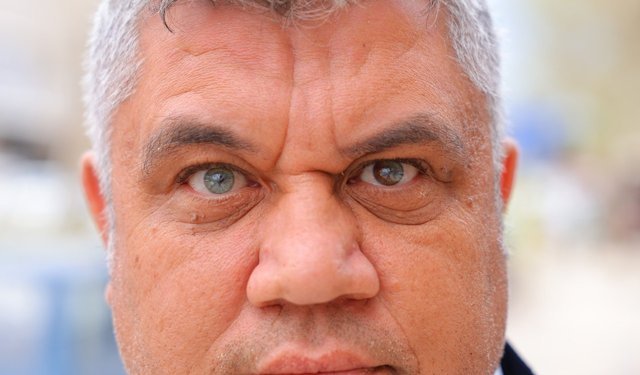 Kahramanmaraşlı adamın 3 renkli gözleri görenleri şaşırtıyor