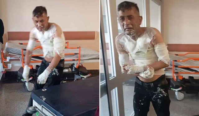 Engelli Vatandaşı Benzinle Yakan Sanığa 18 Yıl Hapis Cezası Verildi