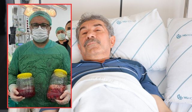 Kahramanmaraş’ta Kilo Kaybı Şikayetiyle Gitti, Böbreğinden 20 Santimlik Dev Tümör Çıktı