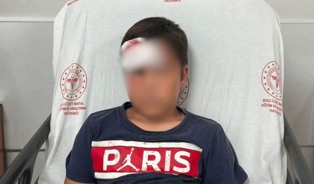 Parkta oynarken üzerine demir direk devrilen çocuk yaralandı