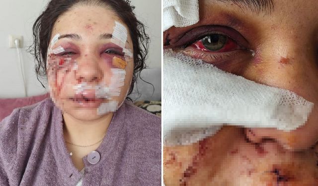 Eşini döven polis tahliye edildi, kadın da hapis cezası aldı