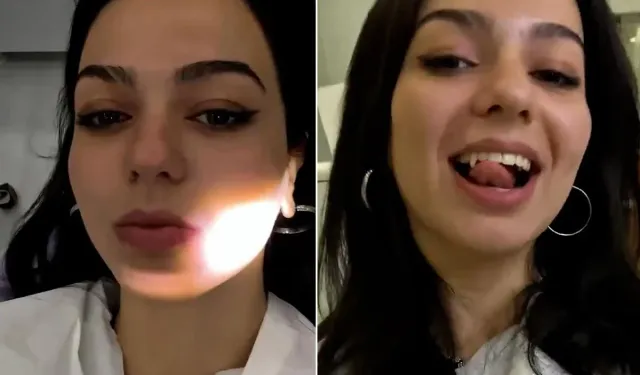Yeni estetik akımı şaşkına çevirdi! Genç kadın “vampir dişi” yaptırdı