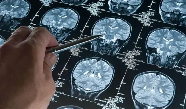 Bilim insanlarından Alzheimer için umut veren keşif: Derin uyku detayı