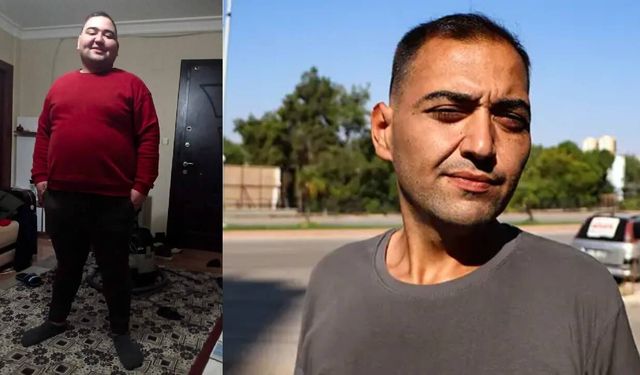 Tüp mide ameliyatı sonrası hayatı karardı: "Günden güne eriyorum"