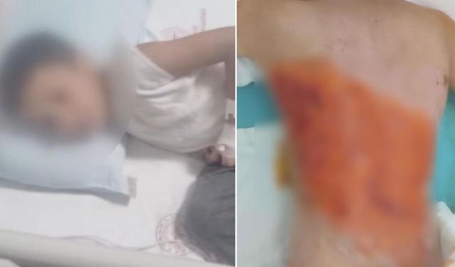 12 yaşındaki çocuğu diri diri yaktılar! Sonrası daha da korkunç