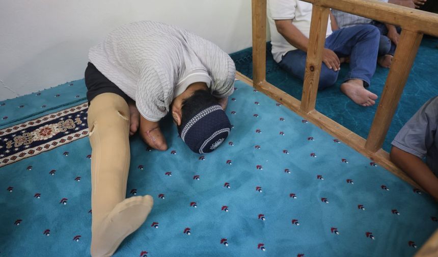 Elektrik akımına kapılan genç kollarını ve bacağını kaybetti! Hayata ibadetle tutundu