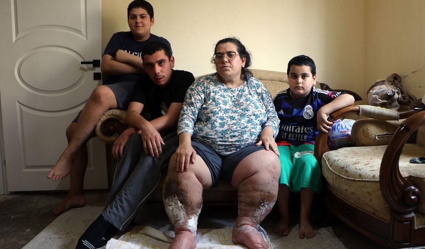 Fil Hastalığıyla Mücadele Eden Annenin Tek Hayali Yeniden Yürüyebilmek