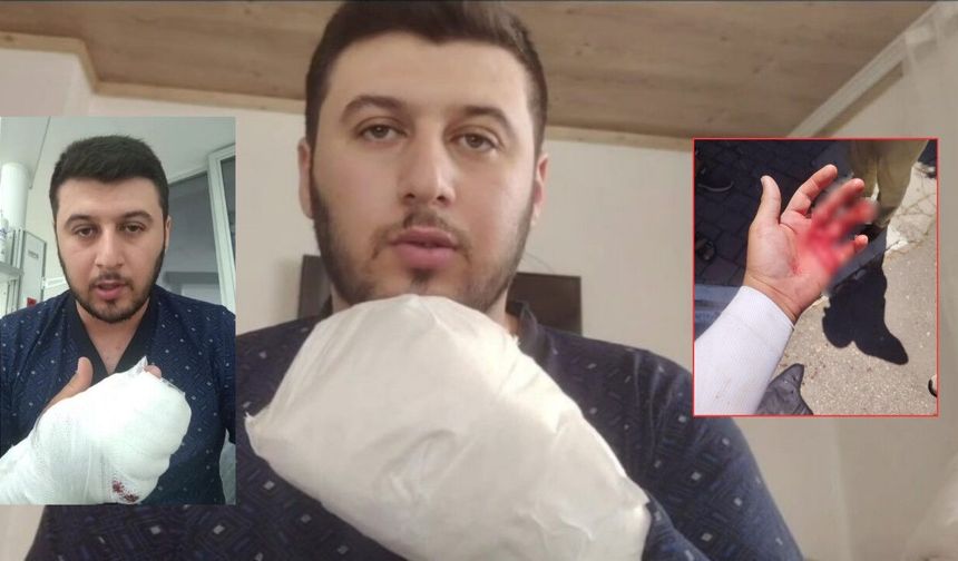 Sipariş tartışmasında motokurye döner bıçağıyla yaralandı!