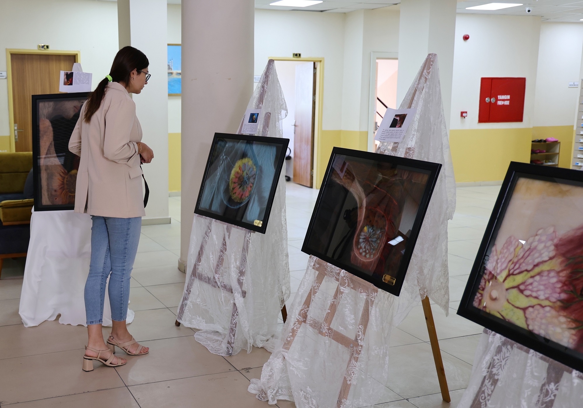 Kanseri 3 Kez Yenen Havva Öğretmen, Keçe Sanatıyla Yeniden Hayata Tutundu (2)