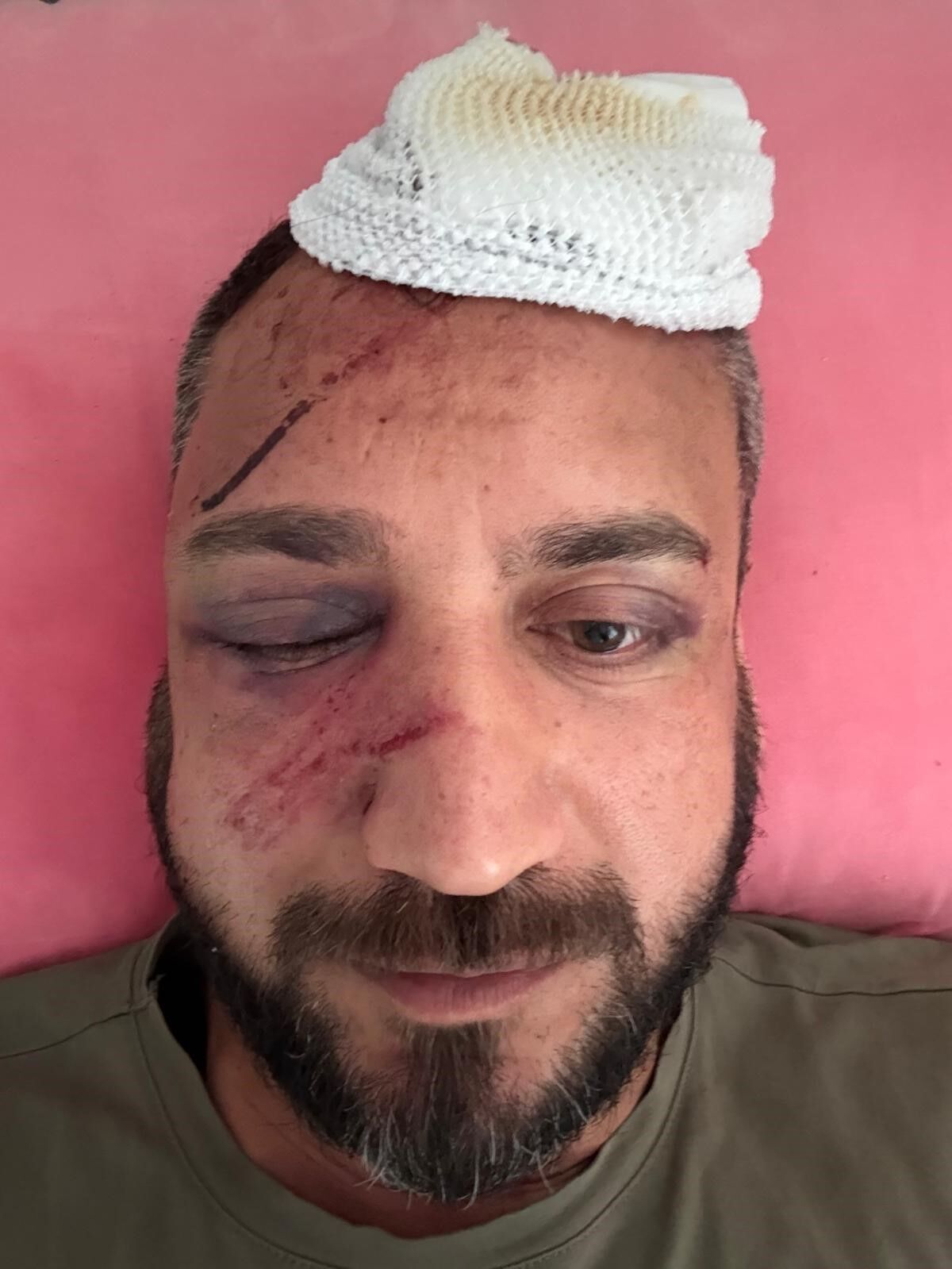 Aşk Bitti, Şiddet Başladı 470 Bin Tl’lik Borç Krizi (2)