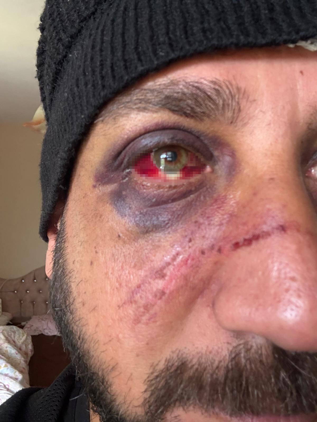 Aşk Bitti, Şiddet Başladı 470 Bin Tl’lik Borç Krizi (3)