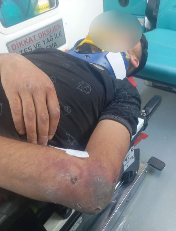 Adana’da Gençleri Sopayla Dövdüğü İddia Edilen Şüpheli Serbest Bırakıldı (5)