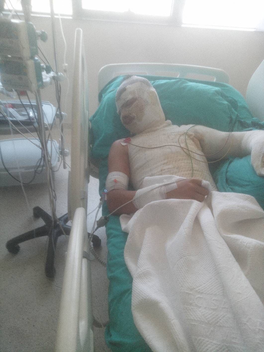 Adana’da Kan Donduran Saldırı Amca Yeğenini Yaktı, O Anlar Kamerada (2)