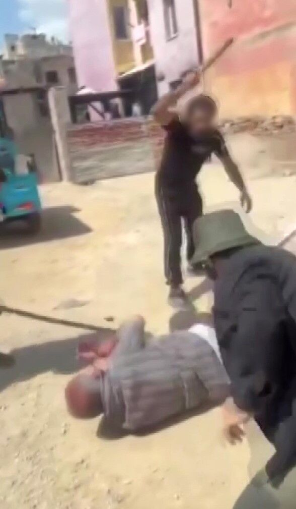 Adli Kontrolle Serbest Kalan Zanlıdan Yeni Şiddet Yaşlı Adamı Da Sopayla Dövdü (3)