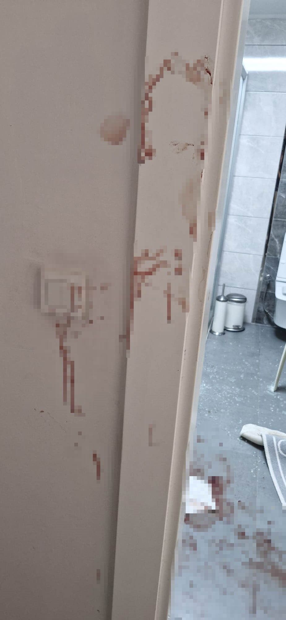 Antalya’da Duşakabin Faciası 80 Yaşındaki Hoca Ölümden Döndü (1)