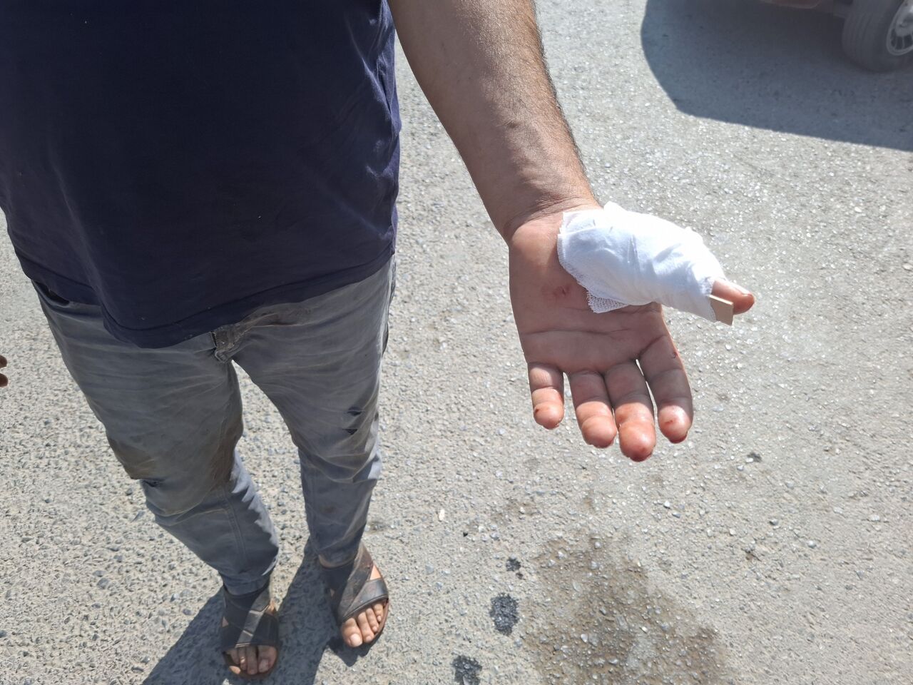 Kahramanmaraş'ta Acemi Kasaplar Bayramın İlk Kurbanı Oldu (2)