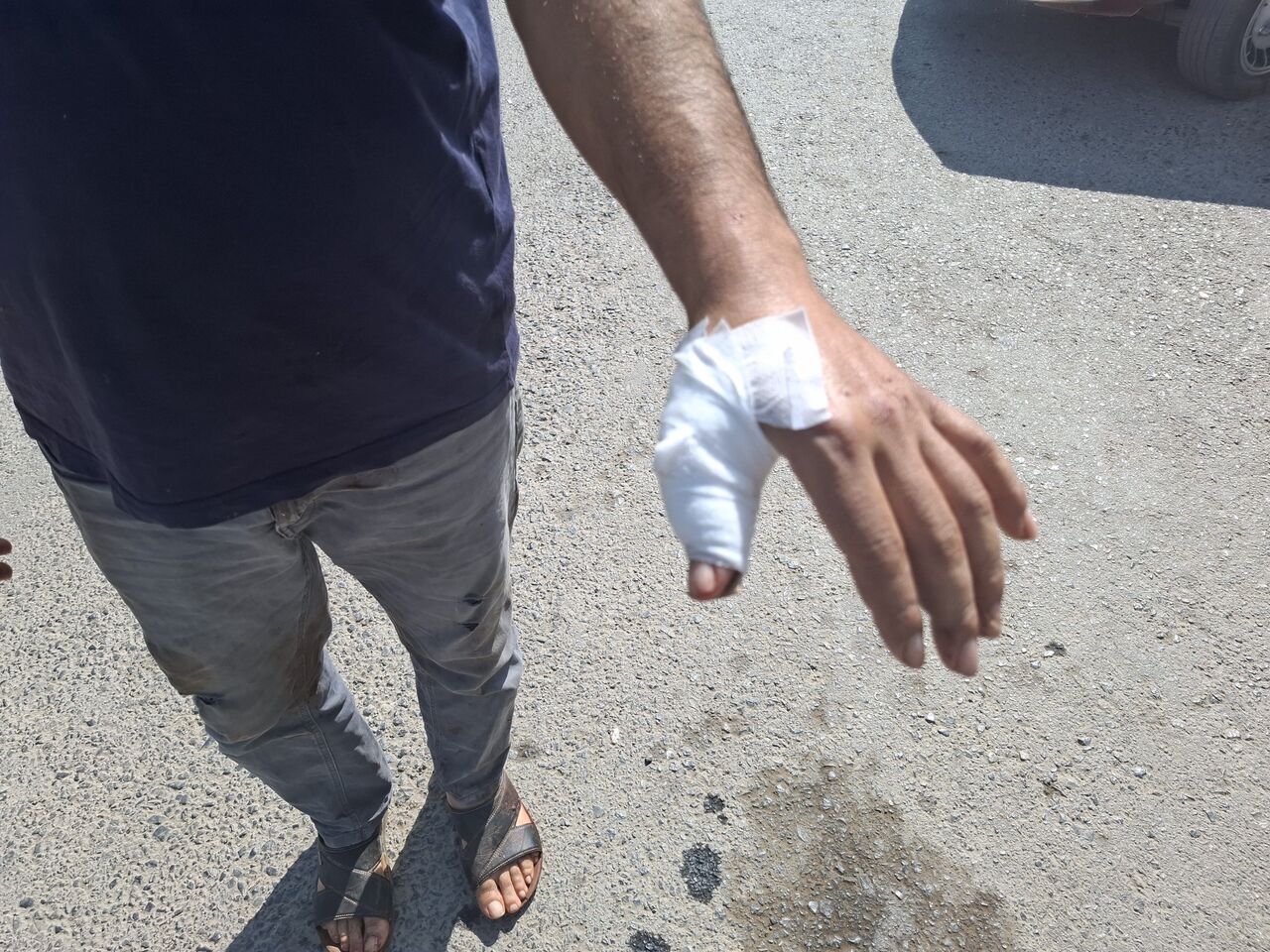 Kahramanmaraş'ta Acemi Kasaplar Bayramın İlk Kurbanı Oldu (3)