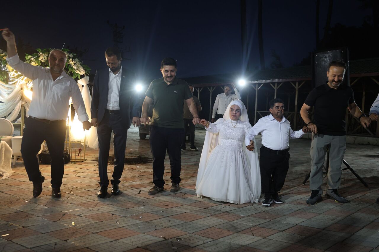 21 Yıl Sonra Kavuştular Cüce Çiftin Yarım Kalan Aşkı Gelinlikle Taçlandı (3)