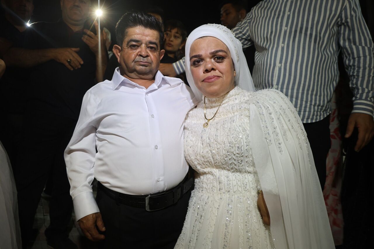 21 Yıl Sonra Kavuştular Cüce Çiftin Yarım Kalan Aşkı Gelinlikle Taçlandı (5)