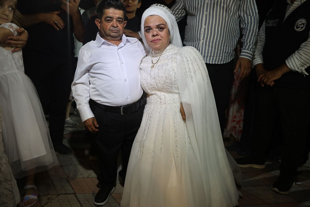 21 Yıl Sonra Kavuştular Cüce Çiftin Yarım Kalan Aşkı Gelinlikle Taçlandı (6)