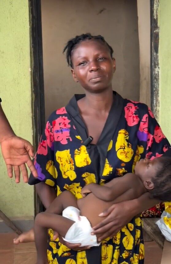 Antalya’da Başarılı Karaciğer Nakliyle Nijeryalı Minik Mercy’nin Umut Yolculuğu (3)