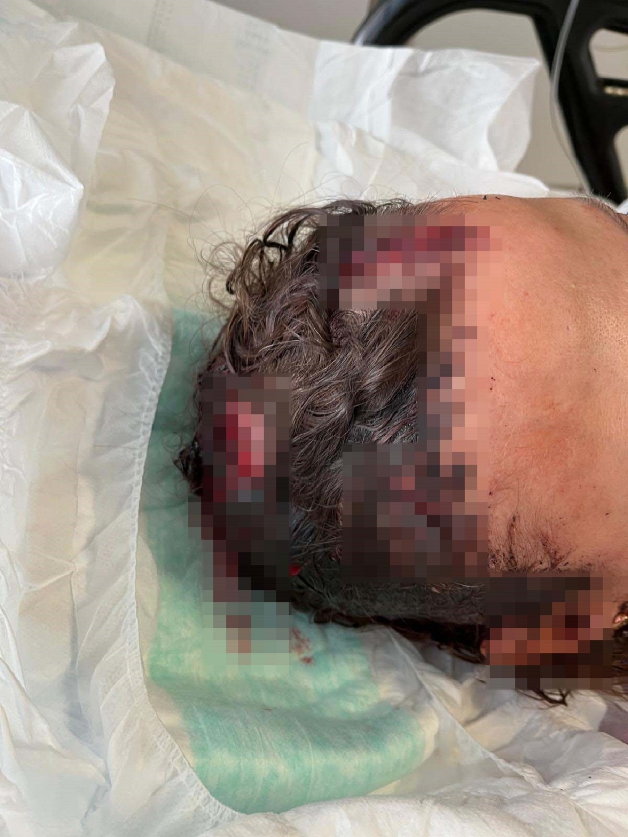 Antalya'da Uzaklaştırma Kararı Aldıran Kadın Dehşeti Yaşadı (9)