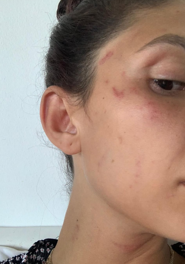 Can Yaman’ın Sevgilisi Sara Bluma’dan Kan Donduran Itiraf “Şiddet Gördüm, Artık Susmayacağım” (2)