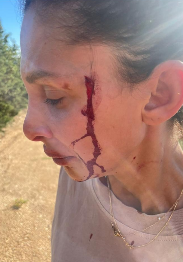 Can Yaman’ın Sevgilisi Sara Bluma’dan Kan Donduran Itiraf “Şiddet Gördüm, Artık Susmayacağım” (3)