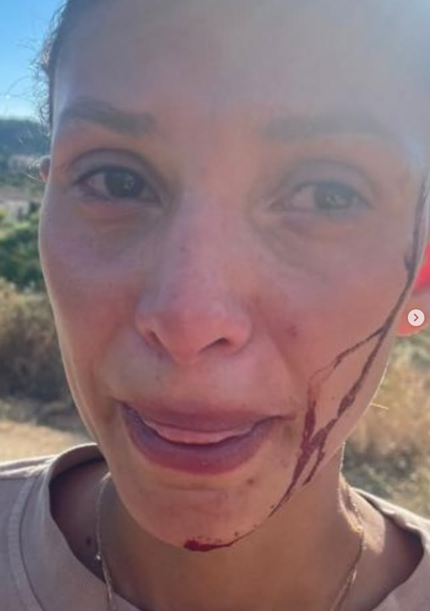 Can Yaman’ın Sevgilisi Sara Bluma’dan Kan Donduran Itiraf “Şiddet Gördüm, Artık Susmayacağım” (4)