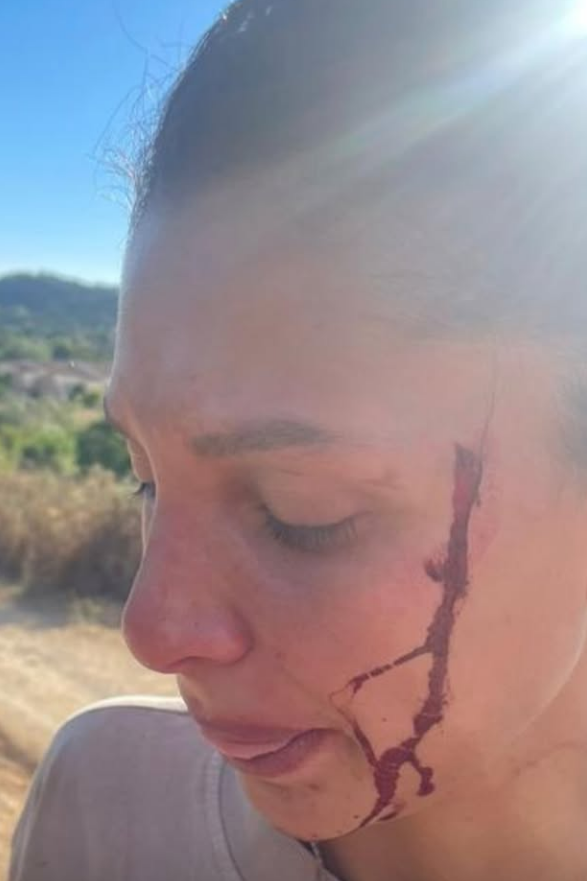 Can Yaman’ın Sevgilisi Sara Bluma’dan Kan Donduran Itiraf “Şiddet Gördüm, Artık Susmayacağım” (5)