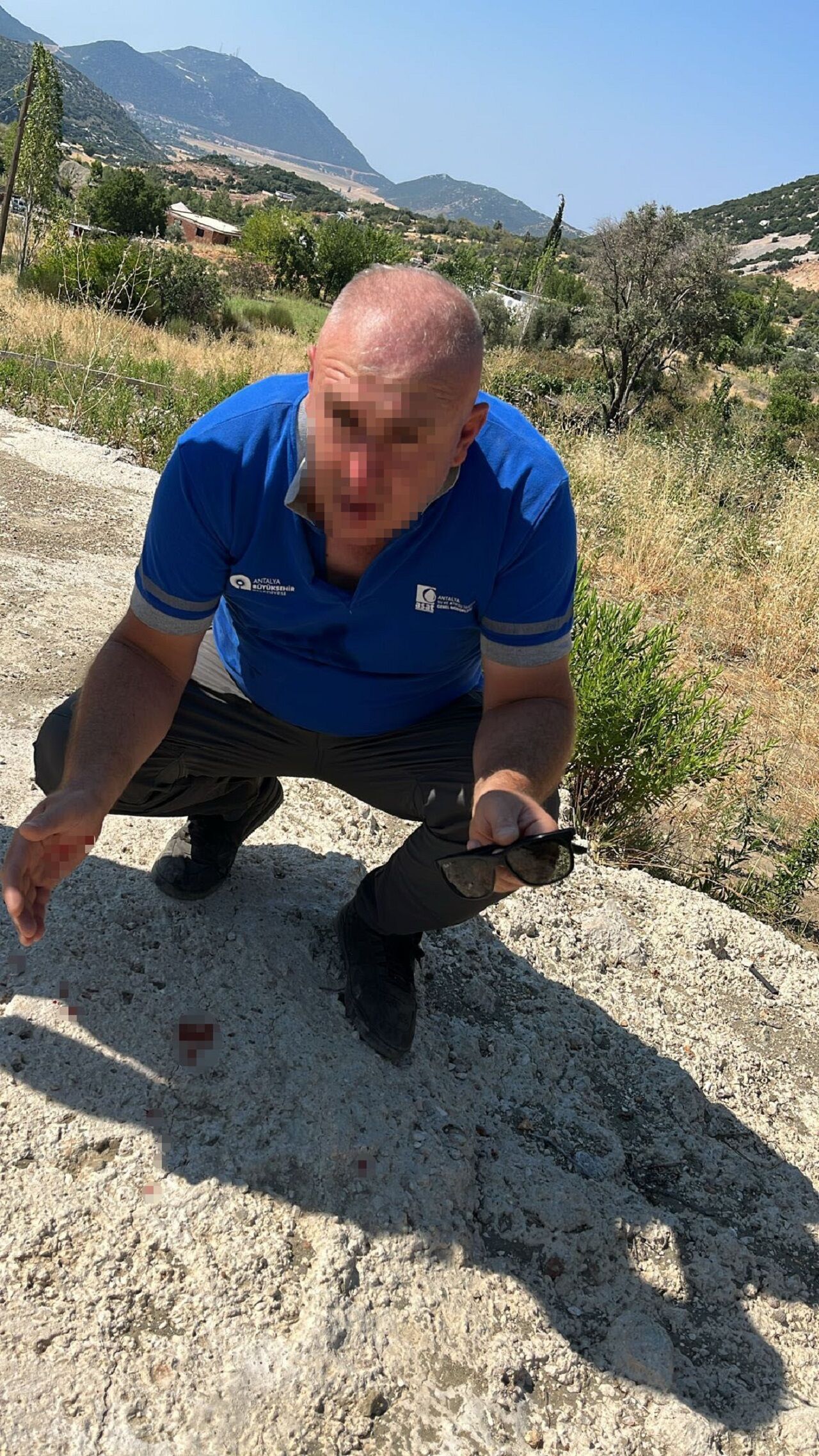 Depodan Izinsiz Su Çekimini Denetleyen Personelin Burnunu Kırdı (5)