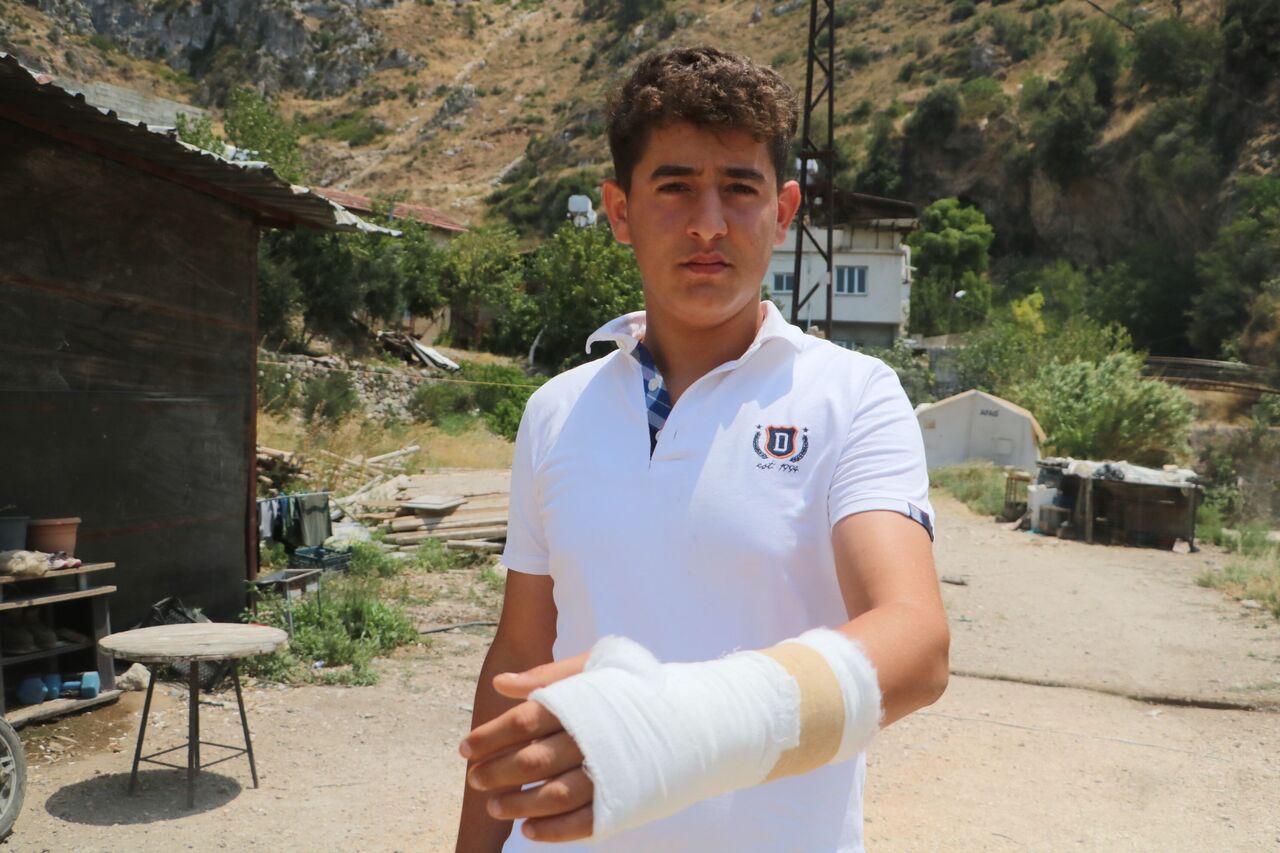 Evini Alevlerden Kurtarmaya Çalışırken Eli Kırıldı Hataylı Gencin Fedakârlığı Yürek Burktu (2)