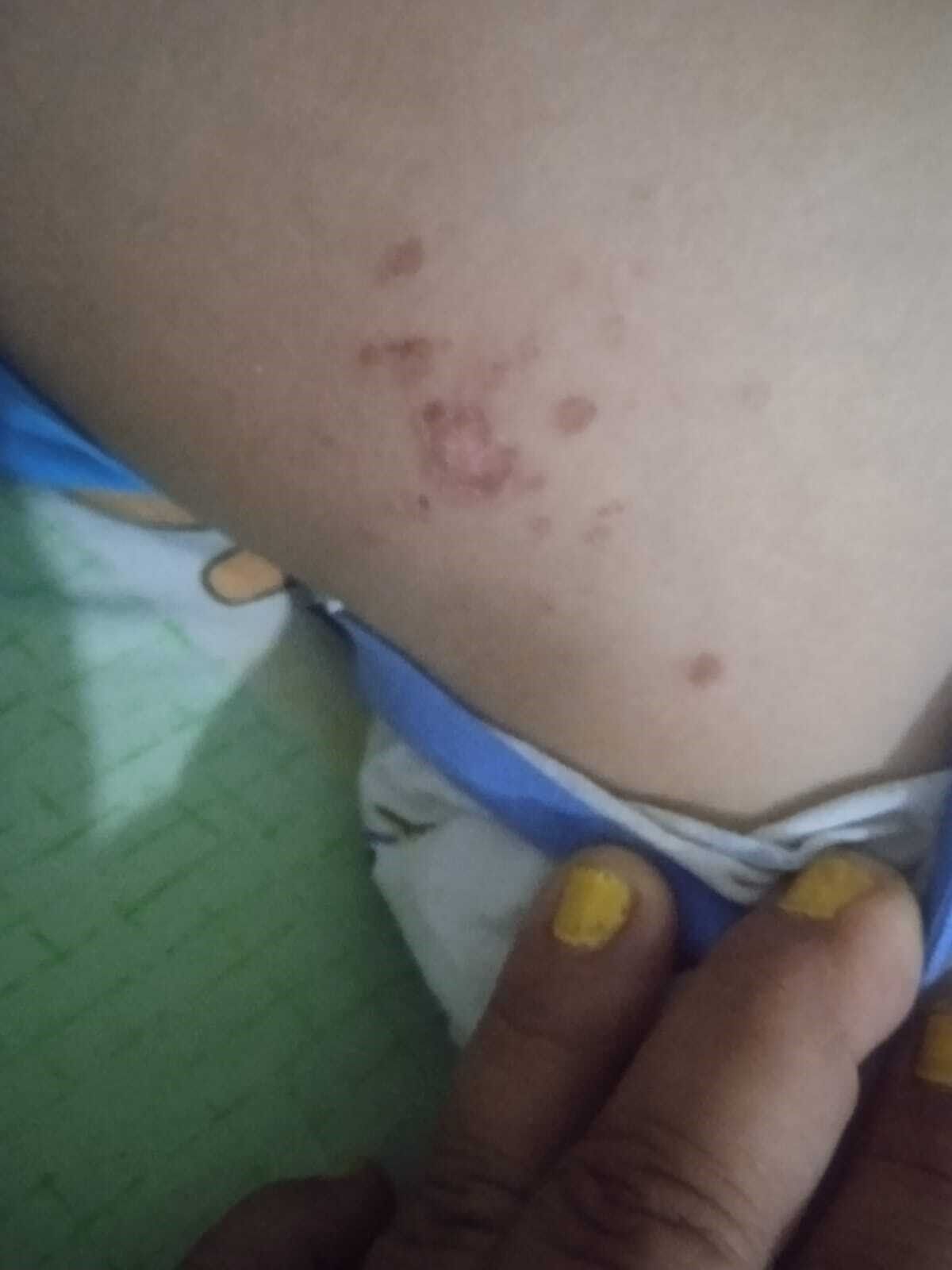 Gazipaşa’da Denize Giren Çocukta Enfeksiyon Şüphesi Atık Su Borusu Gündemde (3)