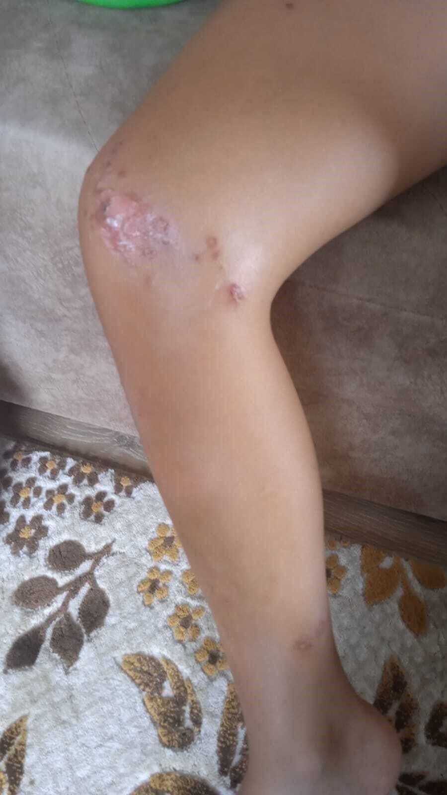 Gazipaşa’da Denize Giren Çocukta Enfeksiyon Şüphesi Atık Su Borusu Gündemde (4)