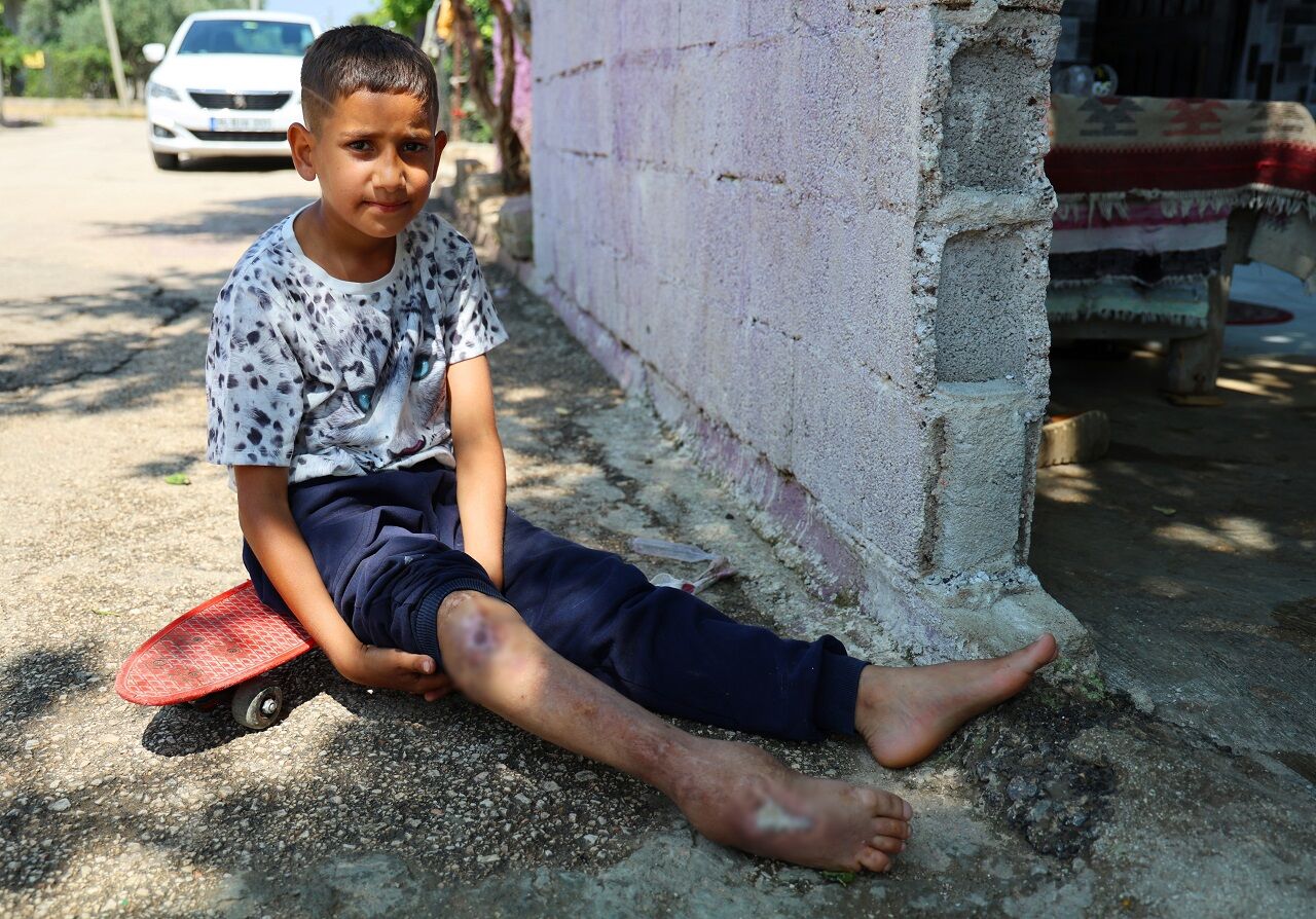 Hayatı Kaykay Üzerinde Geçen Serdal, Artık Yürüyor (7)